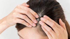 Kulit Kepala Sehat Jadi Kunci Utama Gaya Hidup Modern