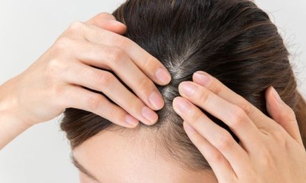 Kulit Kepala Sehat Jadi Kunci Utama Gaya Hidup Modern