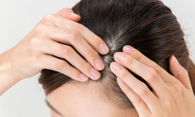 Kulit Kepala Sehat Jadi Kunci Utama Gaya Hidup Modern
